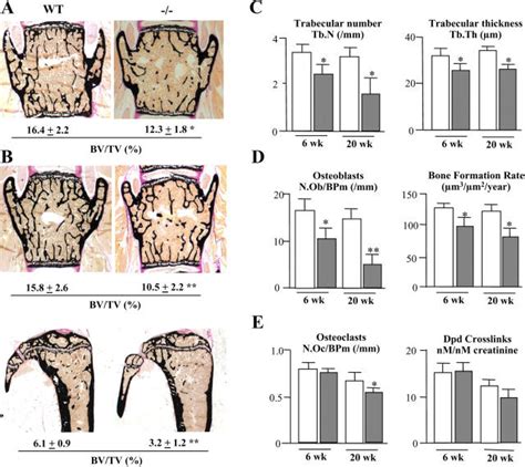 Osteopenia In Sox Deficient Mice A Von Kossa Staining Of