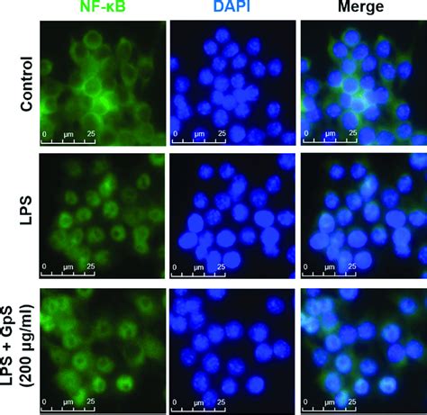 Gps Inhibits Nuclear Translocation Of Nf B P In Lps Induced Raw