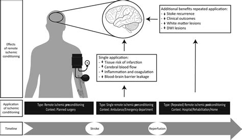 Remote Ischemic Conditioning As An Additional Treatment For Acute