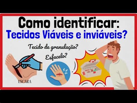 Como Identificar Os Tecidos Vi Veis E Invi Veis Numa Ferida