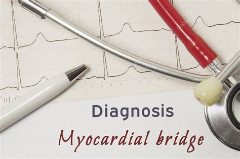 Myocardial Bridge