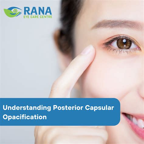 Understanding Posterior Capsular Opacification