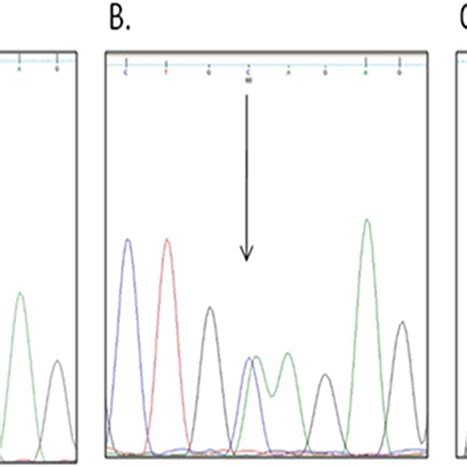 Partial Sequence Chromatograms Of Lys751Gln Polymorphism From Study