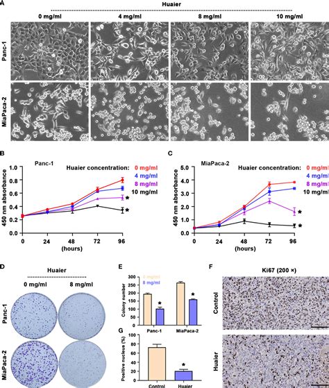 Frontiers Huaier Suppresses Pancreatic Cancer Progression Via