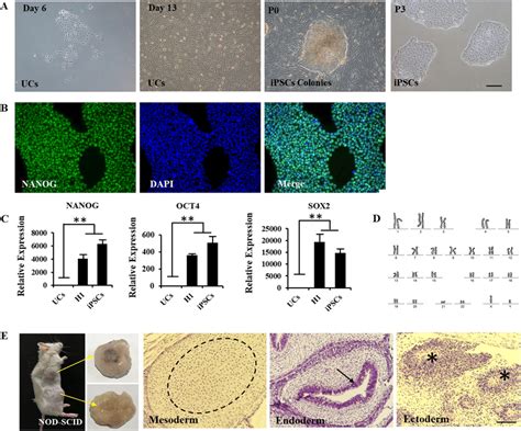 Characterization Of IPSCs Lines Obtained Upon Reprogramming Of Urinary