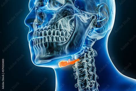 Hyoid Bone X Ray