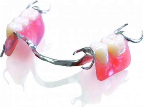 Partial Dentures - Gorey Denture Clinic