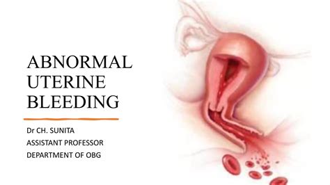 Abnormal Uterine Bleedingpptx