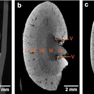 CT slices and volume rendering of the low-resolution microCT data ...