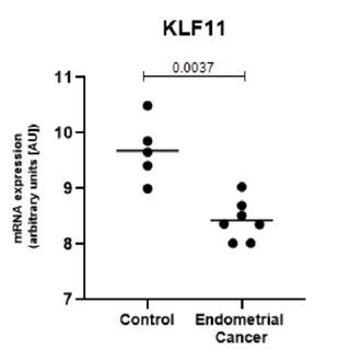 KLF11 Is Expressed At Significantly Lower Levels In The Endometrial