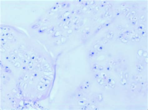 Hematoxylin And Eosin Stained Slide Photograph Showing Mature