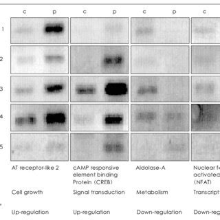 The Results Of Semiquantitative Rt Pcr For The Tested Genes In The