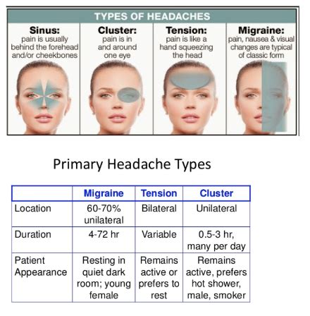 Tension headache Flashcards | Quizlet