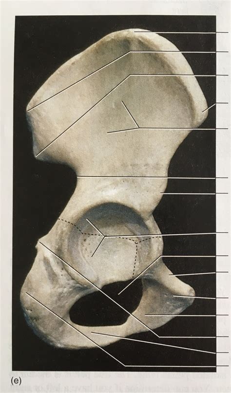 Coxal Bone Lateral View Real Diagram Quizlet