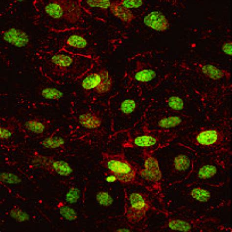 Human Retinal Endothelial Cells Innoprot Ocular Cell System