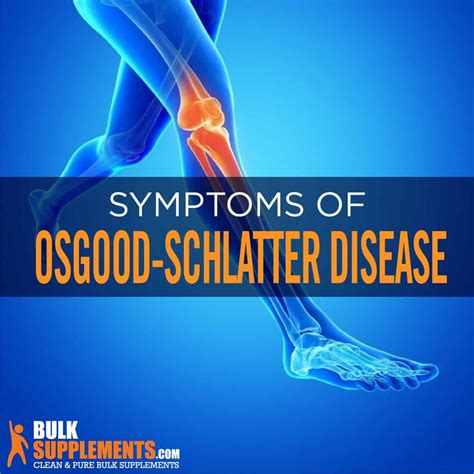 Osgood-Schlatter Disease: Symptoms, Causes & Treatment