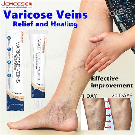 Jemeesen Varicose Veins Effective Remover Cream Spider Vein Pain Killer Cream Varicose Veins