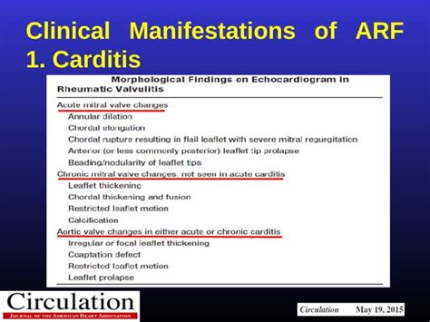 Modified Jones Criteria In The Era Of Echo Ppt