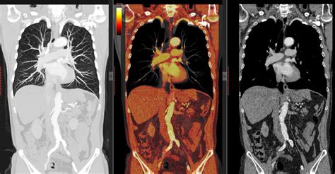 PET Scan Vs CT Scan: Similarities And Differences, 46% OFF