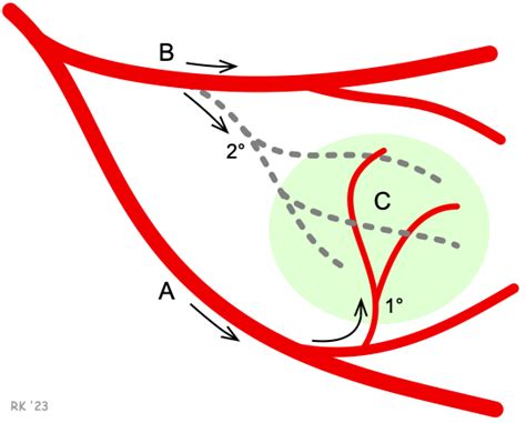 Cv Physiology Collateral Blood Flow