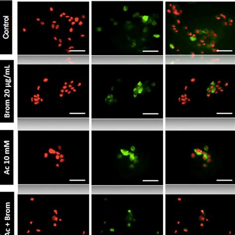 Immunofluorescence Staining Of AsPC 1 Cells Cells Were Stained For