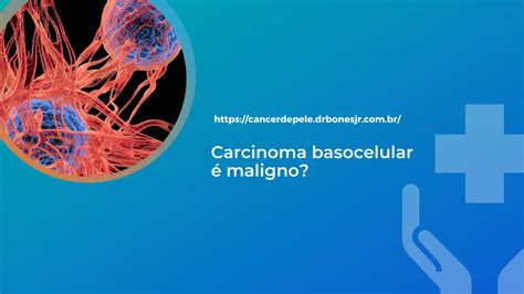 Carcinoma Basocelular é Maligno Especialista Em Câncer De Pele