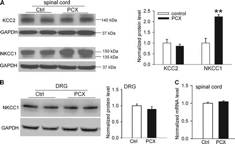 Paclitaxel Treatment Increases Nkcc But Not Kcc Protein Levels In