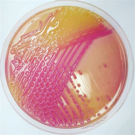 Klebsiella Pneumoniae On Macconkey Agar