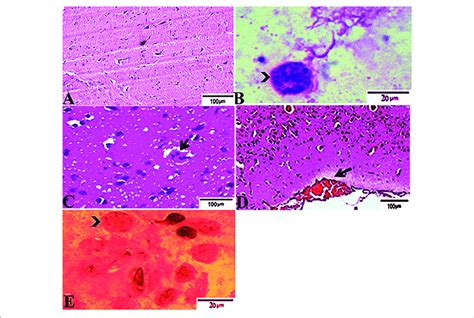 | Photomicrograph of brain sections from experimental mice groups ...