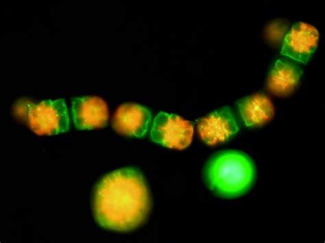 Descubre El Increíble Potencial Del Microscopio De Luz Ultravioleta