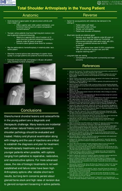 Management of Glenohumeral Osteoarthritis in Young Patients