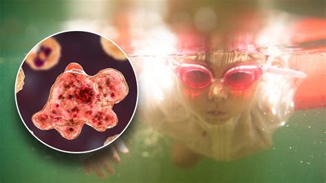 Brain Eating Amoebas What You Must Know About The Risk Of Swimming In Fresh Water Total News