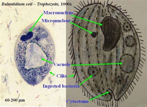 Balantidium Coli