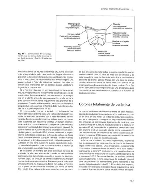 Fundamentos Esenciales En Protesis Fija