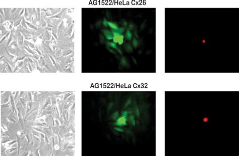 Transfer Of Calcein Green Dye Junction Permeable From Hela Cells