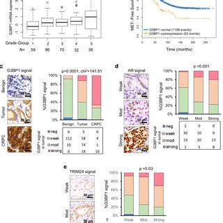 G Bp Deregulates Potential Oncogenic Pathways And Activates