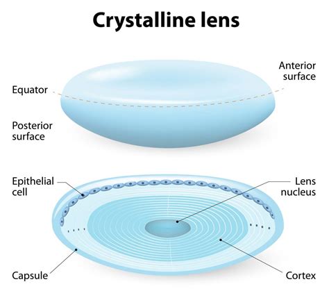 Cataract Surgery And Crystalens®