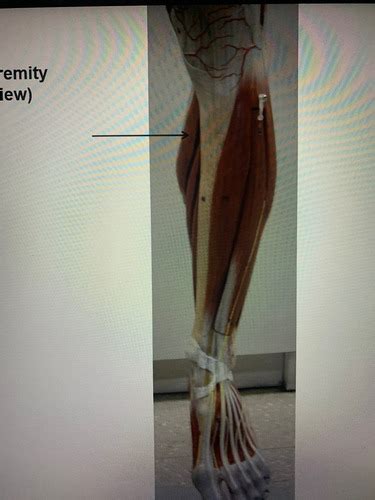 Distal Lower Extremity Anterior Posterolateral Flashcards Quizlet