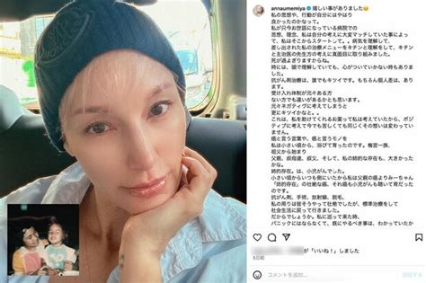 【独自】梅宮アンナ「いよいよ右胸とお別れ」乳がん手術前の“歯の準備”と術後の不安を本人に聞いた（3ページ目） 週刊女性prime