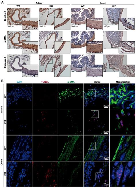 Depletion Of Kindlin In Adult Smooth Muscle Leads To Apoptosis A