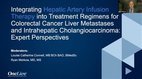 Integrating Hepatic Artery Infusion Therapy Into Treatment Regimens For