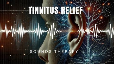 Hours Extremely Powerful Tinnitus Sound Therapy Ringing In Ears