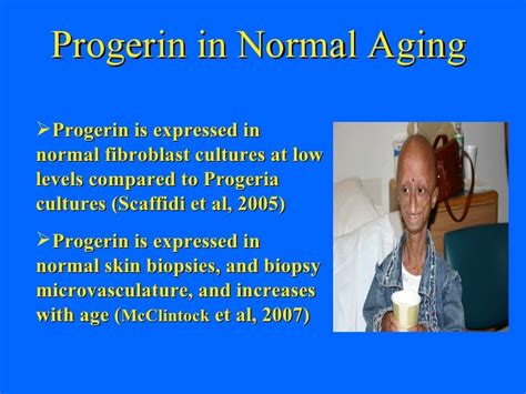 Progeria Research Foundation At Partnering For Cures