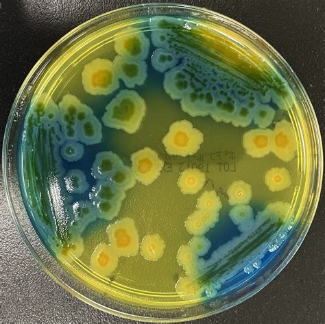 Wataru Hayashi On Twitter Escherichia Coli Drigalski Agar