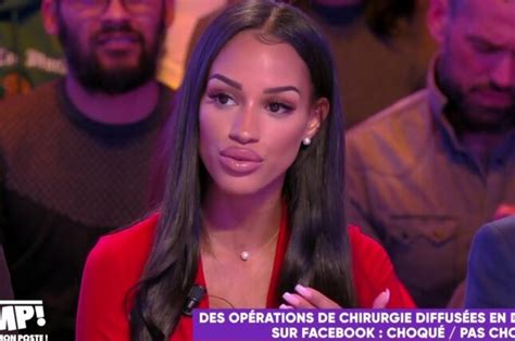 Fanny Neguesha la chroniqueuse de TPMP a t elle subi des opérat