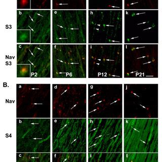 Localization Of S In Nodal Regions Of The Pns Sections Through Rat