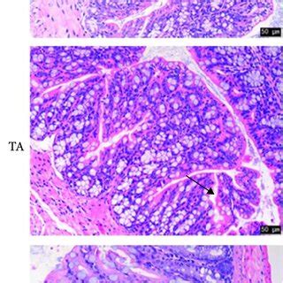 Dss Induced Colitis In Balb C Mice A He Staining Of The Colon