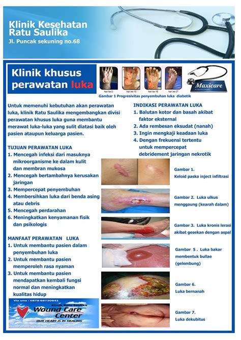 Klinik Perawatan Luka Homecare