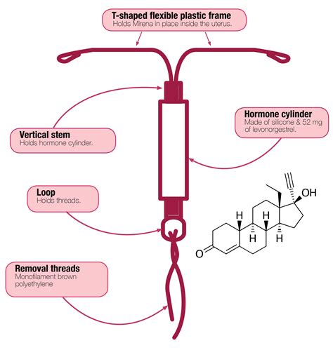 What Is Mirena Mirena Iud