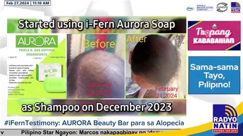 Iferntestimony Aurora Beauty Bar Para Sa Alopecia Hair Loss